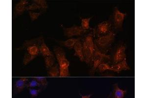 Immunofluorescence analysis of HeLa cells using DMD Polyclonal Antibody at dilution of 1:100.