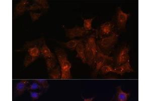 Immunofluorescence analysis of HeLa cells using DMD Polyclonal Antibody at dilution of 1:100. (Dystrophin anticorps)