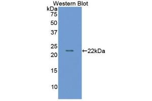 Detection of Recombinant MMP9, Bovine using Polyclonal Antibody to Matrix Metalloproteinase 9 (MMP9)