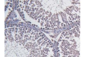 DAB staining on IHC-P; Samples: Rat Testis Tissue) (Fibulin 1 anticorps  (AA 347-521))