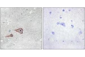 Immunohistochemistry analysis of paraffin-embedded human brain tissue, using CDH3 Antibody.
