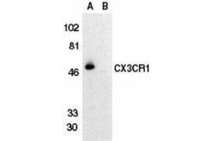 Western blot analysis of CX3CR1 in THP-1 cell lysate in the absence (lane A) or presence (lane B) of blocking peptide with AP30265PU-N CX3CR1 antibody at 1/500 dilution. (CX3CR1 anticorps  (Extracellular Loop))