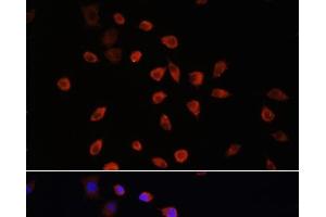 Immunofluorescence analysis of L929 cells using IFT88 Polyclonal Antibody at dilution of 1:100.