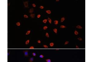 Immunofluorescence analysis of L929 cells using IFT88 Polyclonal Antibody at dilution of 1:100. (IFT88 anticorps)