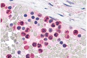 Human Neutrophils: Formalin-Fixed, Paraffin-Embedded (FFPE) (TLR4 anticorps  (C-Term))
