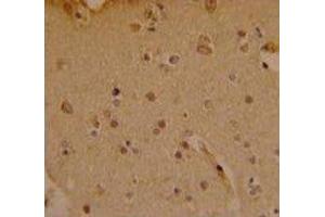 IHC analysis of FFPE human brain stained with SOX4 antibody