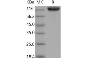 Western Blotting (WB) image for Intercellular Adhesion Molecule 1 (ICAM1) (Active) protein (His tag,Fc Tag) (ABIN7196240)