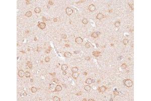 Immunohistochemistry of paraffin-embedded Rat brain using KCNJ4 Polyclonal Antibody at dilution of 1:100 (40x lens). (KCNJ4 anticorps)
