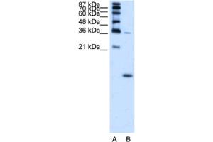 Western Blotting (WB) image for anti-Hemoglobin, zeta (HBZ) antibody (ABIN2462551) (HBZ anticorps)