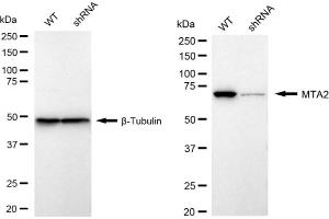 Western blotting analysis using MTA2 antibody (ABIN7799378). (Recombinant MTA2 anticorps)