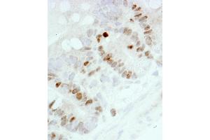 Immunohistochemistry (IHC) image for anti-Antigen Identified By Monoclonal Antibody Ki-67 (MKI67) (AA 1650-1700) antibody (ABIN7448620)