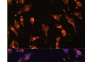 Immunofluorescence analysis of L929 cells using SSTR2 Polyclonal Antibody at dilution of 1:100 (40x lens). (SSTR2 anticorps)
