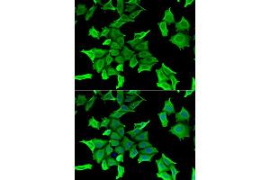 Immunofluorescence analysis of HeLa cells using SPINT2 antibody. (SPINT2 anticorps)