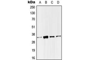 Western blot analysis of SMUG1 expression in HeLa (A), Molt4 (B), Raw264. (SMUG1 anticorps  (Center))
