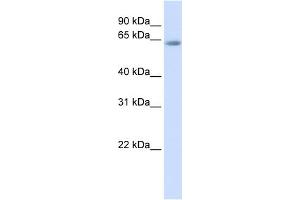 WB Suggested Anti-TCF7L2 Antibody Titration:  0.
