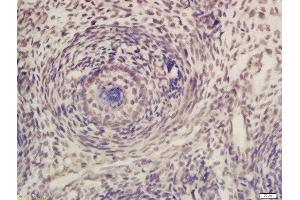 Formalin-fixed and paraffin embedded mouse embryo labeled with Rabbit Anti-CDK7 Polyclonal Antibody, Unconjugated (ABIN670251) at 1:200 followed by conjugation to the secondary antibody and DAB staining