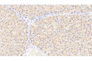 Detection of HSPb2 in Human Liver Tissue using Polyclonal Antibody to Heat Shock Protein Beta 2 (HSPb2)