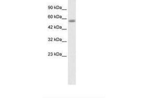Image no. 1 for anti-Kelch-Like 36 (KLHL36) (AA 134-183) antibody (ABIN202817) (KLHL36 anticorps  (AA 134-183))
