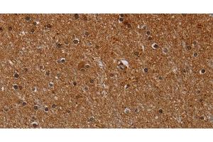 Immunohistochemistry of paraffin-embedded Human brain using CYP1A2 Polyclonal Antibody at dilution of 1:40 (CYP1A2 anticorps)