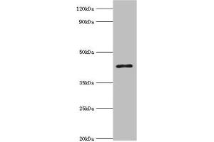Western blot All lanes: 3-ketoacyl-CoA thiolase, peroxisomal antibody at 8 μg/mL + Mouse liver tissue Secondary Goat polyclonal to rabbit IgG at 1/10000 dilution Predicted band size: 45, 35 kDa Observed band size: 45 kDa (ACAA1 anticorps  (AA 27-300))
