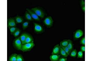 Immunofluorescent analysis of A549 cells using ABIN7174759 at dilution of 1:100 and Alexa Fluor 488-congugated AffiniPure Goat Anti-Rabbit IgG(H+L) (C17orf78 anticorps  (AA 1-186))