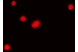 Immunofluorescent analysis of Fibrillarin staining in Hela cells.