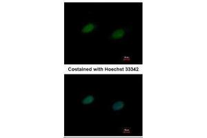 ICC/IF Image Immunofluorescence analysis of paraformaldehyde-fixed HeLa, using UBA2, antibody at 1:500 dilution. (UBA2 anticorps  (N-Term))