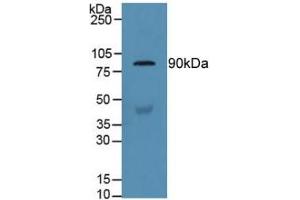 Detection of GSN in Human Serum using Polyclonal Antibody to Gelsolin (GSN) (Gelsolin anticorps  (AA 432-625))