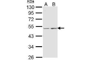 WB Image Sample (30 ug of whole cell lysate) A: A431 , B: Hela 10% SDS PAGE antibody diluted at 1:1000 (COX15 anticorps  (Center))