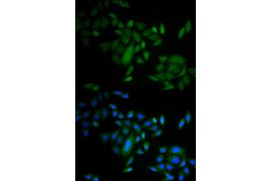 Immunofluorescence analysis of A549 cells using CASP9 antibody (ABIN5971434). (Caspase 9 anticorps)