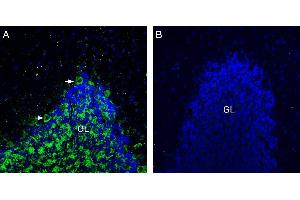 Expression of Neuroligin-3 in rat cerebellum. (Neuroligin 3 (NLGN3) Peptide)