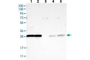 Western blot analysis of Lane 1: RT-4, Lane 2: U-251 MG, Lane 3: Human Plasma, Lane 4: Liver, Lane 5: Tonsil with YWHAQ polyclonal antibody . (YWHAB anticorps)