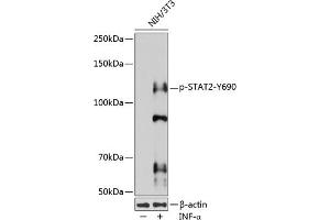 Western blot analysis of extracts of various cell lines, using Phospho-ST-Y690 pAb (ABIN3020024, ABIN3020025, ABIN3020026 and ABIN6225501) at 1:1000 dilution. (STAT2 anticorps  (pTyr690))