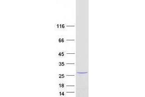 Transgelin 3 (TAGLN3) (Transcript Variant 2) protein (Myc-DYKDDDDK Tag)