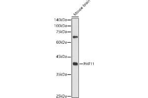 Western blot analysis of extracts of Mouse brain, using PHF11 antibody (ABIN6128437, ABIN6145533, ABIN6145535 and ABIN6217420) at 1:500 dilution.