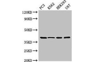 Western Blot Positive WB detected in: PC-3 whole cell lysate, K562 whole cell lysate, HEK293 whole cell lysate, U87 whole cell lysate All lanes: SLAMF1 antibody at 3 μg/mL Secondary Goat polyclonal to rabbit IgG at 1/50000 dilution Predicted band size: 38, 34, 41 kDa Observed band size: 38 kDa (SLAMF1 anticorps  (AA 69-204))