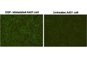 Immunofluorescent staining of EGF-stimulated A431 cells and untreated A431 cells with Phosphotyrosine monoclonal antibody, clone E10 . (Phosphotyrosine anticorps)