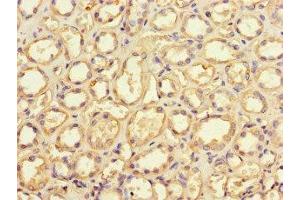 Immunohistochemistry of paraffin-embedded human kidney tissue using ABIN7149644 at dilution of 1:100 (GRID2IP anticorps  (AA 35-156))
