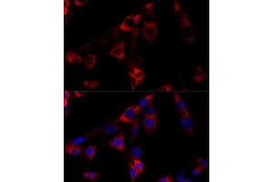 Immunofluorescence analysis of NIH-3T3 cells using HSP90B1 Polyclonal Antibody (ABIN6130434, ABIN6142031, ABIN6142033 and ABIN7101795) at dilution of 1:100 (40x lens).