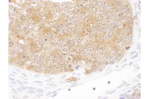 Immunohistochemistry (IHC) image for anti-serine Hydroxymethyltransferase 1 (Soluble) (SHMT1) (AA 453-483) antibody (ABIN7455015)