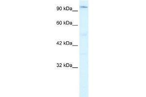 Human Jurkat; WB Suggested Anti-ZNF409 Antibody Titration: 0. (ZFHX2 anticorps  (Middle Region))