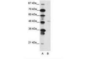 Image no. 1 for anti-Mesenchyme Homeobox 2 (MEOX2) (N-Term) antibody (ABIN202200) (MEOX2 anticorps  (N-Term))