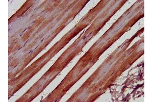 IHC image of ABIN7152702 diluted at 1:500 and staining in paraffin-embedded human skeletal muscle tissue performed on a Leica BondTM system.