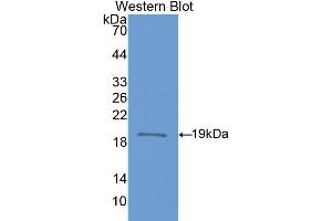 Western blot analysis of the recombinant protein. (NOS1 anticorps  (AA 468-616))