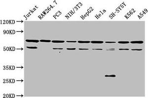 Western Blot Positive WB detected in: Jurkat whole cell lysate, RAW264. (NUP62 anticorps  (AA 173-522))