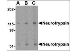 Western blot analysis of neurotrypsin in SK-N-SH cell lysate with this product at (A) 0. (Neurotrypsin anticorps  (N-Term))
