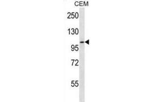 Western Blotting (WB) image for anti-Rhomboid 5 Homolog 2 (RHBDF2) antibody (ABIN2923970) (RHBDF2 anticorps)