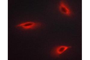 ABIN6267484 staining MCF-7 cells by ICC/IF.