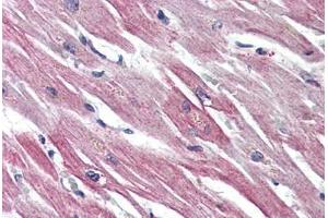 Heart, Human: Formalin-Fixed, Paraffin-Embedded (FFPE)