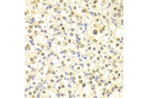 Immunohistochemistry of paraffin-embedded rat heart using DDB2 antibody at dilution of 1:100 (x400 lens). (DDB2 anticorps)